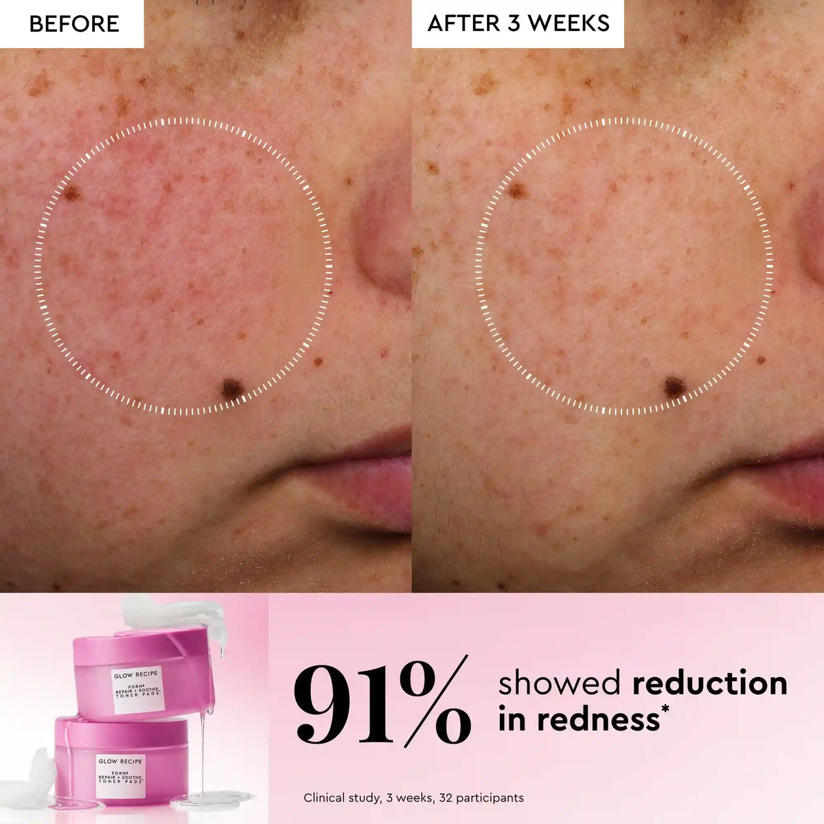 Korean Toner Pad Trial & Travel Kit