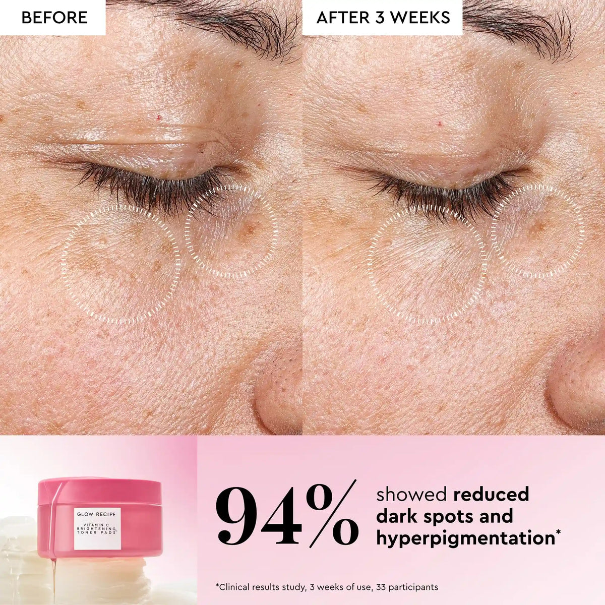 Korean Toner Pad Trial & Travel Kit