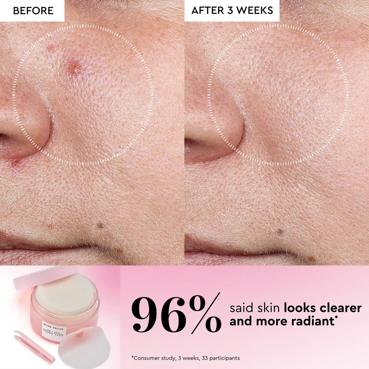 Korean Toner Pad Multi-Masking Kit